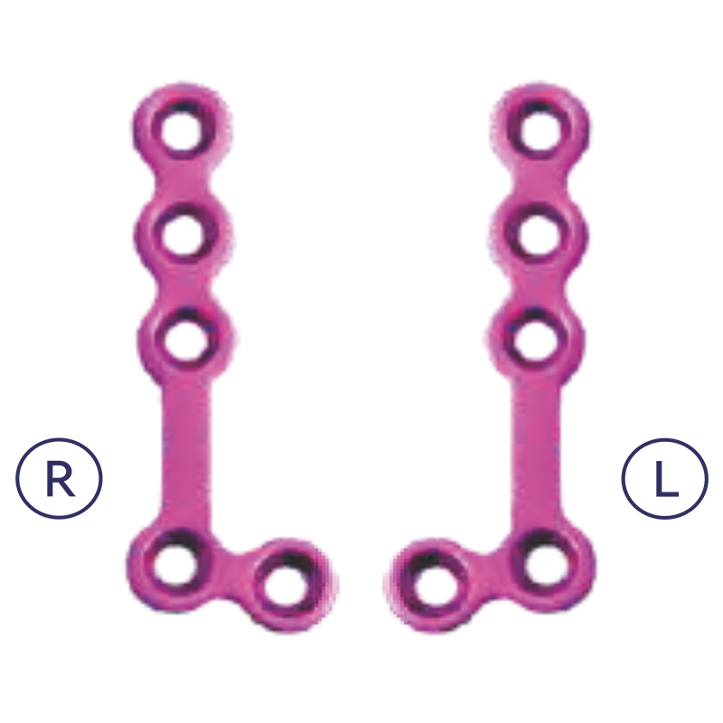 “L” Shape Recon Plate 100°